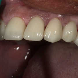 Screenshot 2023-07-11 at 3.59.54 PM