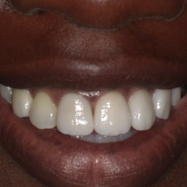 Screenshot 2023-07-11 at 4.00.20 PM