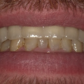 Screenshot 2023-07-11 at 5.06.09 PM