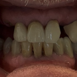 Screenshot 2023-07-11 at 5.06.33 PM