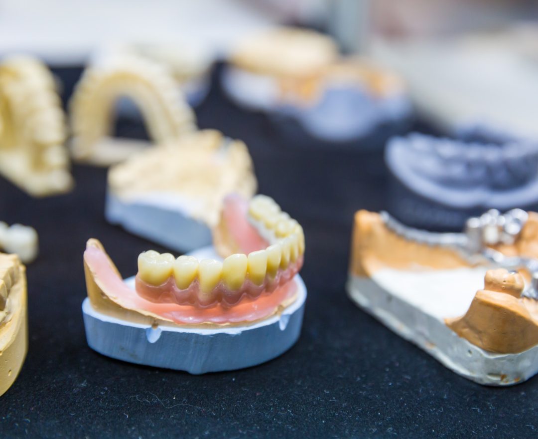 Denture treatment, dental implants closeup